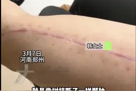咔嚓一声，胳膊断了！这种游戏别太“上头”…图片