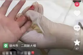 江苏一医生给孩子采血，手套残留他人血迹？当地卫健委介入调查图片