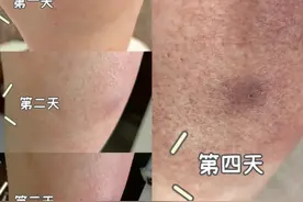 已入侵12个省份！剧毒有致命危险，发现立即上报图片