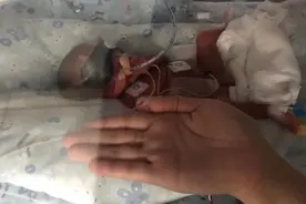 太罕见！湖南双胞胎小姐妹相隔3天出生图片