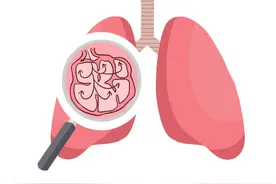 凛冬已至，慢阻肺患者做好以下几点安稳过冬~图片
