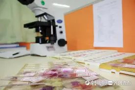 皮肤肿物切除后，为何必须进行病理检查？图片