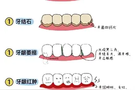 今天起，刷牙请调整一下！图片