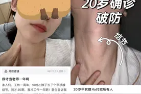 “每天摸800遍，像被判无期徒刑……”95后姑娘得病崩溃！医生：大部分人都有图片
