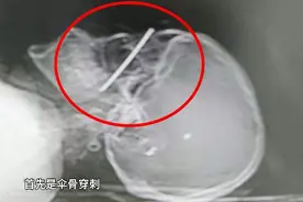 危险！自行车上不要加装这些物品！图片