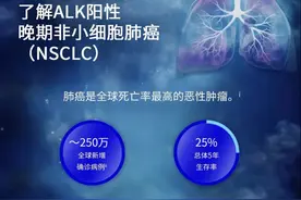 肺癌研究新突破：患者有望实现五年及以上不出现疾病进展图片