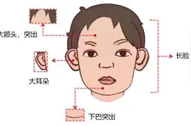 如何逆袭变脆的基因图片