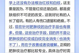 通过涂抹美容护肤用品可以消除肥胖纹？图片