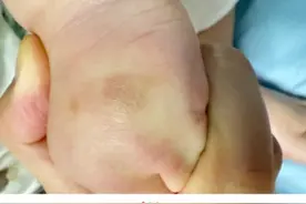 一到晚上嗡嗡吵？这几类人在它们眼里是“真香”，重庆网友哭诉：痒到崩溃图片