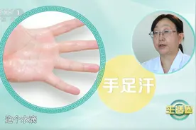 这4个部位出汗多可能暗藏健康隐患！快自查→图片