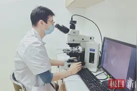 一个月逛8次猫咖，14岁少女染上“宠物癣”头顶脱发图片