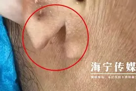裂开！太疼了！浙江女子早上起床后，发现吓人一幕……图片