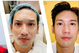 知名男星二级烧伤，因这个行为！图片