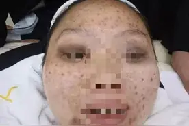 女子被“免费检出面部毒素”，贷款办卡后美容店跑路；警方回应：嫌疑人死亡撤案了图片