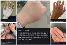 瑞幸咖啡师“烂手”困局：灵活就业者权益如何保障？图片