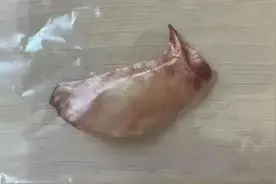 直插心脏！男子吃饭时一个动作，差点送命图片