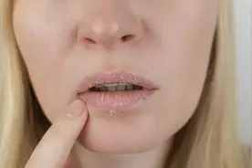 嘴唇干裂容易起皮，只是因为秋冬季节气候干燥？可能是这种习惯害了你图片