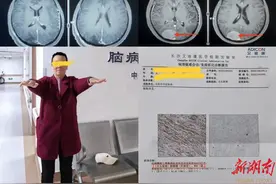 警惕颅内“隐形杀手”——脑膜瘤图片