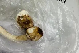 毒性超强！长沙62岁大爷雨后从家中菜地摘下白色蘑菇，没想到吃进ICU图片