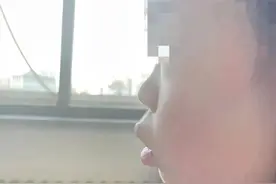 这病会让人越长越丑、还影响智力！上海一医院近期频繁接诊，紧急提醒图片
