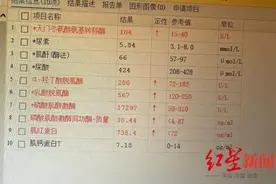男子骑动感单车过猛确诊横纹肌溶解，医生：运动后出现这些症状应就医→图片
