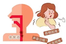 “全球一半食管癌在中国”？专家为你支招，远离吃出来的癌症图片
