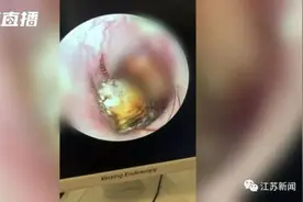“它爬进去了！”小伙痛苦冲进医院，听着就起鸡皮疙瘩图片