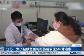江苏一女子被鲈鱼鱼刺扎伤后求医5年才治愈图片