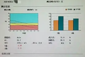 你知道超声骨密度检查和双能X线骨密度检查有什么不同吗图片
