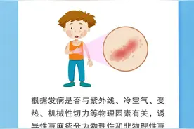 身上一热就起痒疙瘩，怎么办？图片
