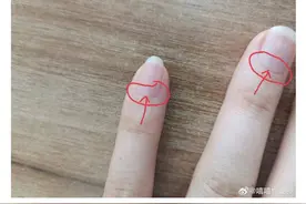 修到出血！你被美甲伤过吗？ 临近春节，想做美甲注意这三点|扬子懂健康图片