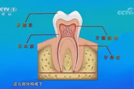 牙不好可能引发脑卒中？！医生手把手教您这样护牙→图片
