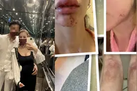 一日韩混血模特在香港被泰拳教练男友虐打超百次，还被强奸偷拍要挟结婚见面视频封面