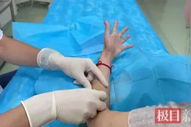 长期拉大提琴，女子大拇指疼得无法弯曲图片