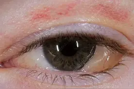 这4个“毁眼”行为不要再做了！再不注意，眼睛真的要“报废”了图片
