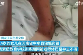 快评丨14岁女生被机构教官体罚致昏迷？严惩之外家长也需反思图片