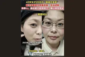 42岁“断崖式衰老”上热搜！专家：较少见，但这些是早衰常见症状图片