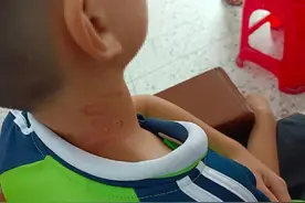 锐评|校长因学生忘戴红领巾动粗？别把停职当作处理终点图片