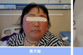 云南首例！为库欣病患者精准“揪”病灶，这家医院有新技术图片