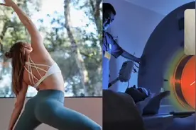女子做核磁检查皮肤被烧出水泡，只因穿了一条好瑜伽裤？图片