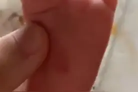 上海一宝妈怒了！月嫂用指甲抠破12天大的婴儿脚底图片