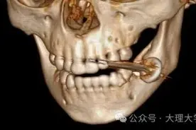 痛心！2岁孩子咬下一口瞬间爆炸！口冒白烟，血肉模糊……图片