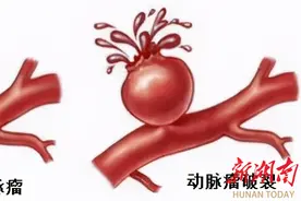 长沙男子急性腹痛致“生死一线”  长沙市第一医院肝胆外科专家慧眼查因、紧急施救图片