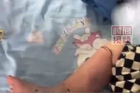 2岁男童住进ICU面临截肢，只因去了趟菜市场？近期已有死亡病例！图片