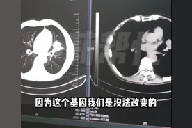 家族9人患癌8人离世！医生：几代人都有这个坏习惯图片
