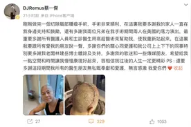 突然退出演唱会 知名男歌手自曝切除脑部肿瘤图片