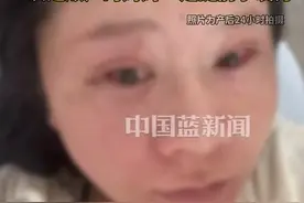 顺产妈妈用错力致整脸肿胀……生产时到底该怎么用力？准妈妈们赶紧收藏！图片