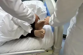 老人多年来下肢瘙痒，原是糖尿病足作怪图片