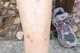 太糟心！厦门一小区车库，跳蚤泛滥成灾！业主晒图：满腿被咬……图片