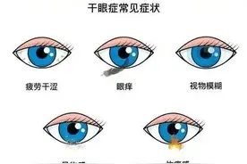 近期突然猛增，严重可致失明！紧急提醒图片